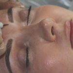 Brow Treatment In Progress