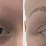 MEDICAL BROWS BA_4